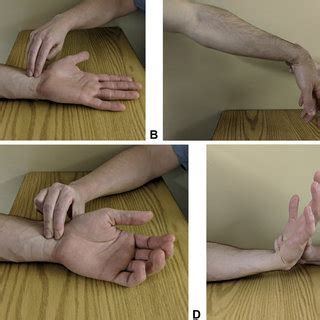 modified carpal compression test|phalen test and tinel sign.